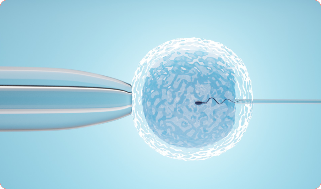 Unlocking Parenthood with IUI